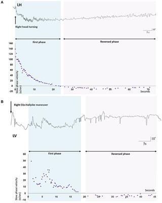 Short-Term Central Adaptation in Benign Paroxysmal Positional Vertigo